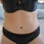 Front view 6 mo. PO