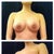 3 weeks Post Op (Day 21)