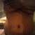 another after pic.. im very satisfied, i can just imagine what it will look like after the swelling go down... very happy