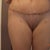 3 weeks post op