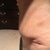 Right hip. Looks like a dog ear :-(