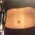 Front view 4 months post op.