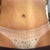 Front view 4 months post op