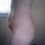 Before tummy, side view.