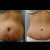 Before and after picture