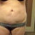 8 weeks post op