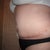 7 weeks post-op