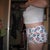 7 weeks post-op