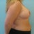 8 weeks post op2
