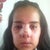 Day 4... looking like a chipmunk! still with my nose really swollen :(