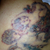 My bandage fell off- this is the morning after my 3rd treatment- it looks dark and blistery.