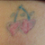 The booty- this is after 2 laser treatments.  A fast result!