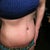 9 weeks post op weight training and cardio.