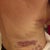 more bruising