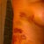 lots of bruising...