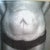 Before unclothed!