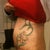Is this just swelling see the bulge around belly button