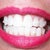 Progress of being on the 9th Invisalign tray. Look how it moved my bottom tooth that was behind the others.