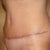 Left view - 4 weeks
