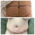 Before and After.