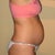 1 year after second child, 1 day before surgery
