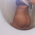 her you can see the fat i wanted removed still there and i cant stand looking at it.