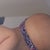 here is my right cheek it seems deformed see how it has an odd shape when you look at it side ways