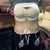 6 Days post op, Front View