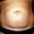 BEFORE: See the tummy mole to the side of my belly button?