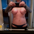 9 Weeks Post -op.