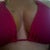 My same breasts just lifted back where they should be. 10 days post op.