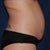 preop side