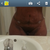 Stomach looks flatter I have a lot of bruising