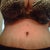 new stretch mark above new belly button