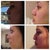 some before and after shots, 3rd week in.