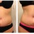 This is my swelling from working out :(  Check out how straight my mid line incision was getting.  You can really see how the swelling pulls the crap out of it.