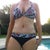 2 months post-op. Pic taken in the evening so some swelling is going on.