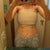 Day after surgery 2-2-12