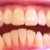 6-6-2012 Tray 7/24