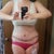 Post op day 12