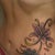 2 1/2 years post op