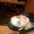 My face n nose very swollen, both from surgery and steriods they had me on lol