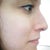 Before Profile