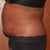 side view 17days post op.  Flanks look good and no hang time.. yay!!!  still swollen.. and looking forward to the weeks ahead..