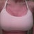 2nd week Post Op