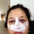 Day of surgery