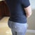 2 week post-op