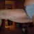 After 4 weeks post op
