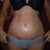 After 4 weeks post op
