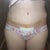 I tend to get more swollen on the top and on the bottom, and the center of my tummy not so much, I mean it's all swollen just more so on top and bottom. My incision looks higher on the one side but Im just super swollen on that end of the incision for some reason??